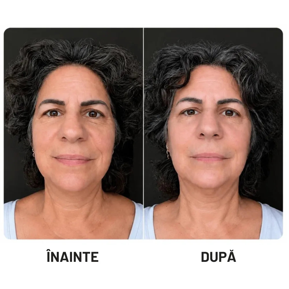 Pulse® Dispozitiv Facial 5-în-1