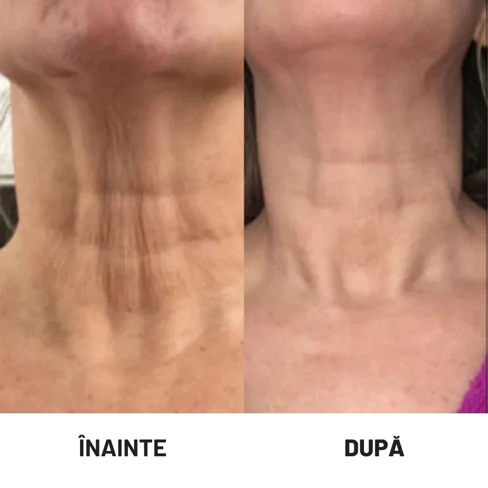Pulse® Dispozitiv Facial 5-în-1