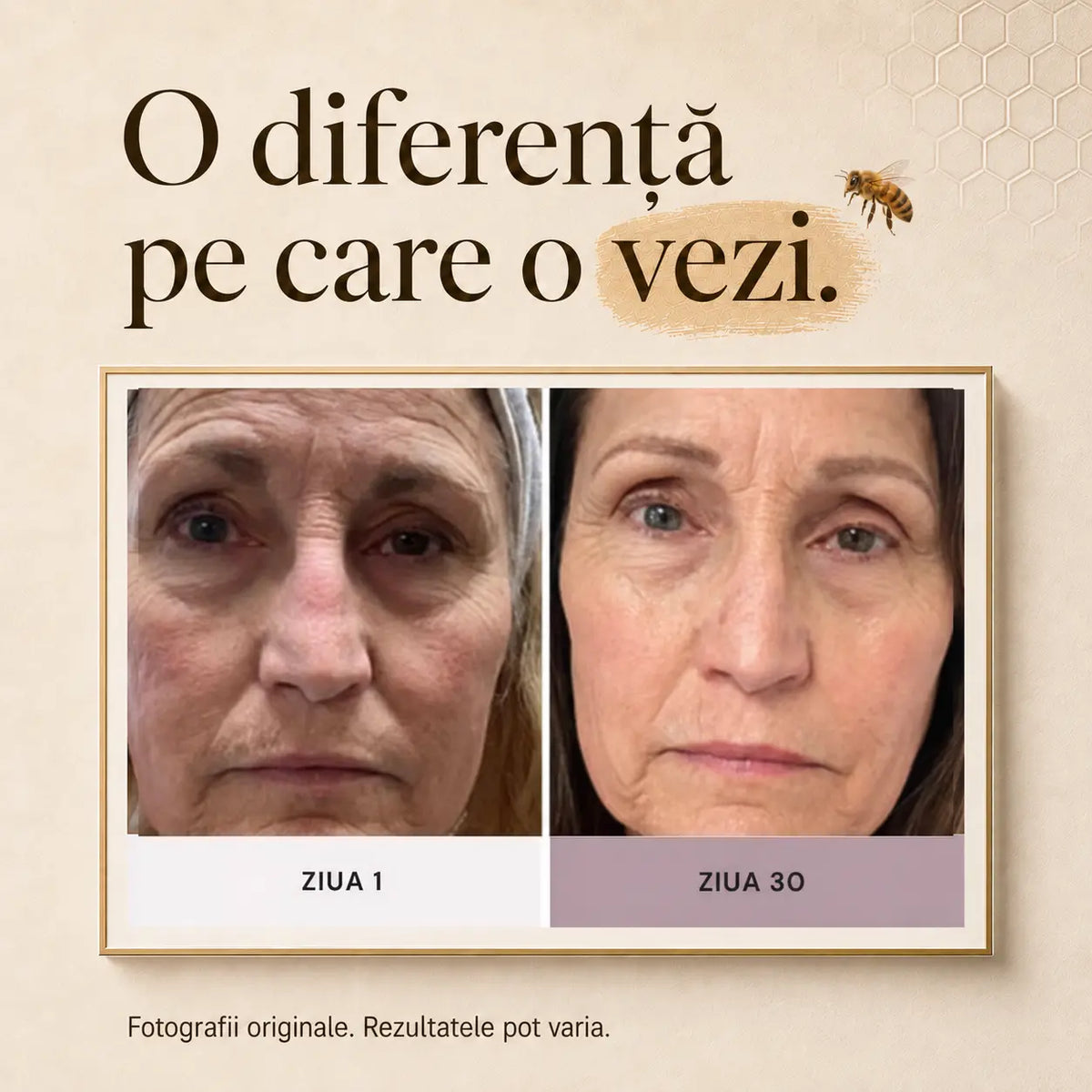Tratament PULSE® Venin