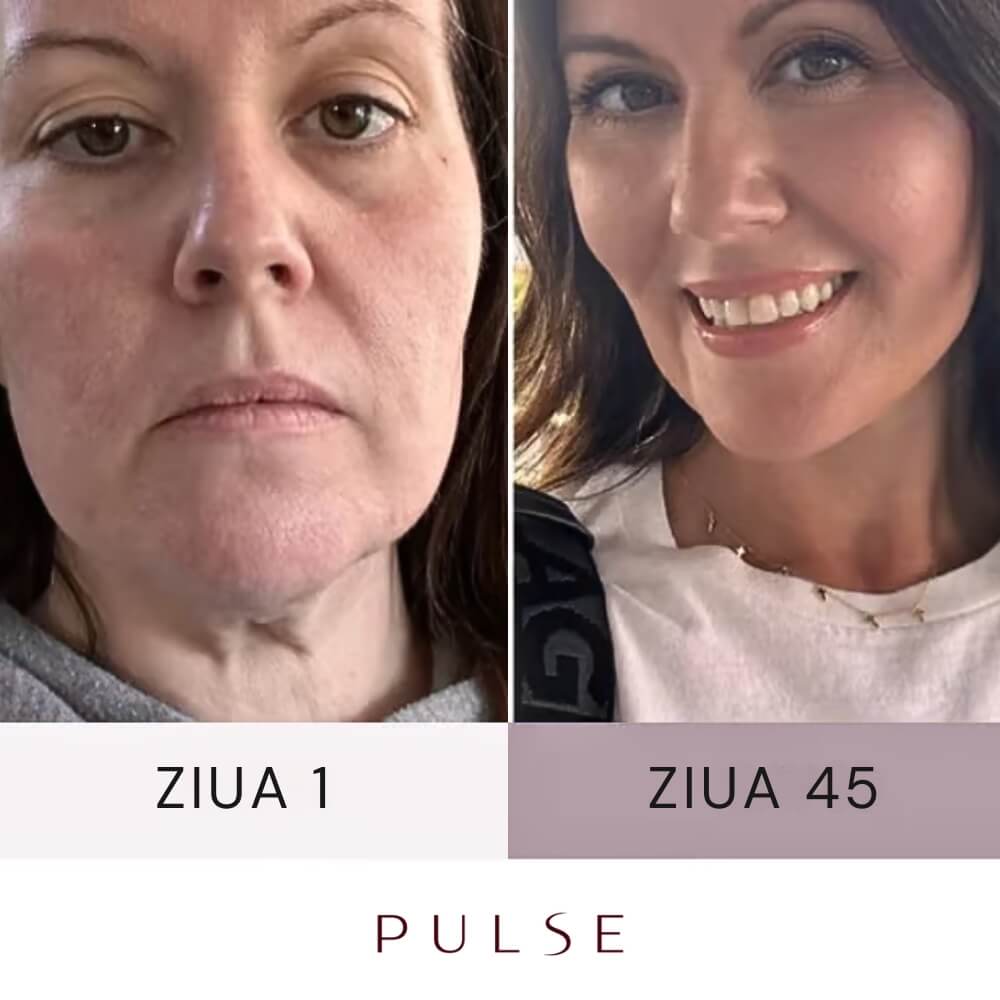 Pulse® Dispozitiv Facial 5-în-1