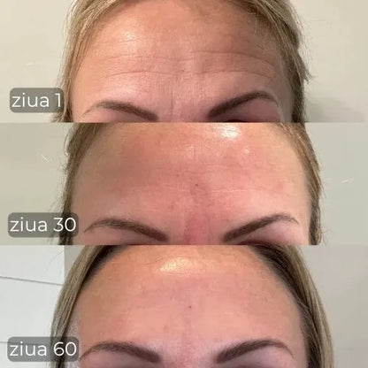 Pulse® Dispozitiv Facial 7-în-1